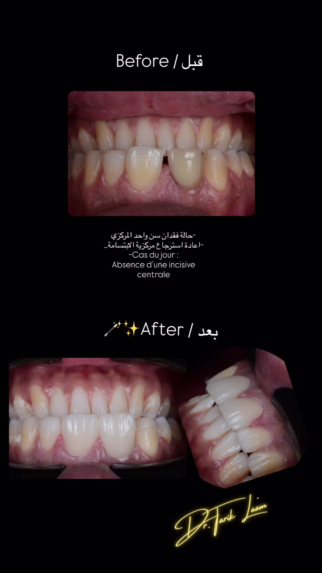@Dr.tarik_laam