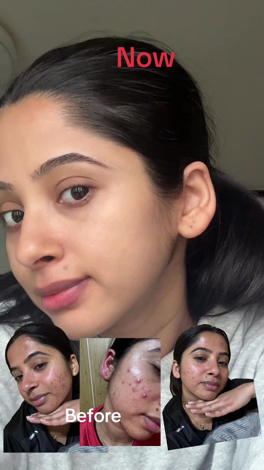 @Sakhila