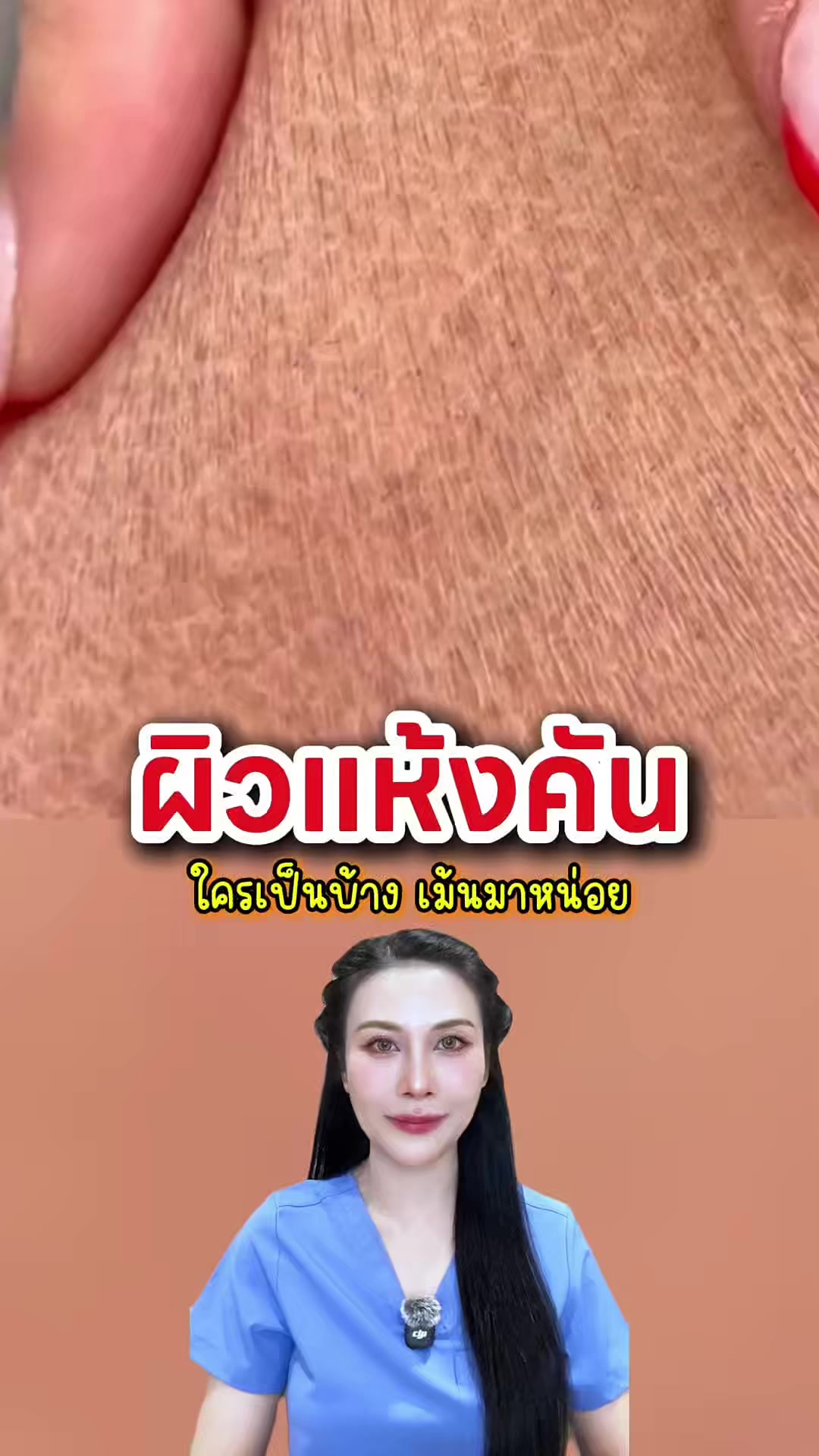 @พยาบาลอัญ