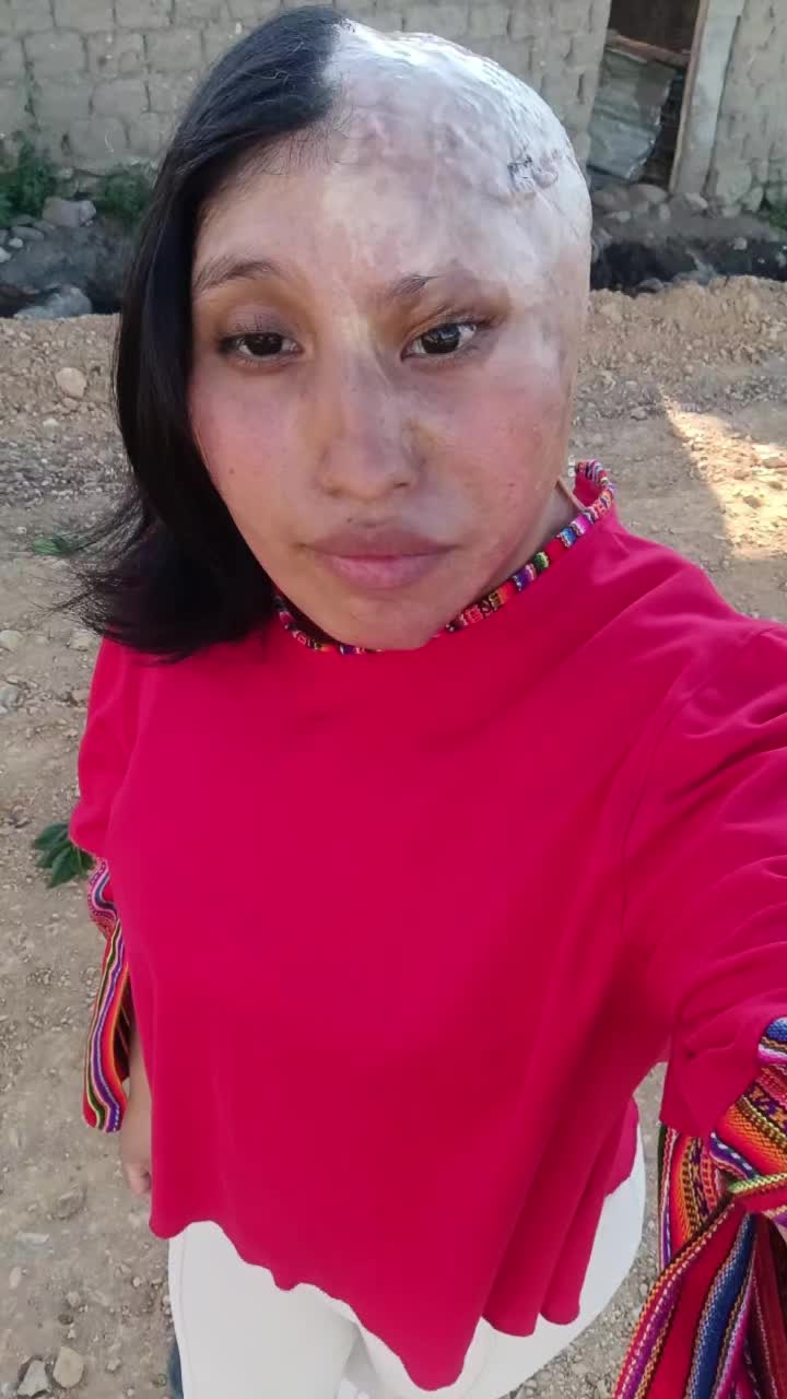 @Elizabeth Carri&oacute;n