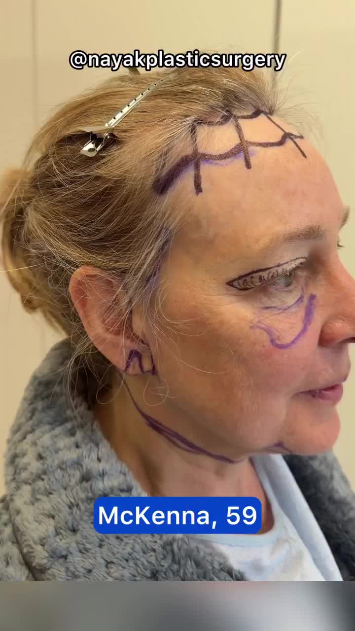 @NayakPlasticSurgery