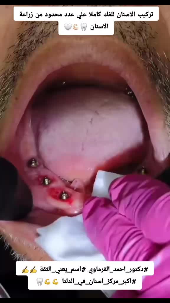 @دكتور احمد طلعت الفرماوي