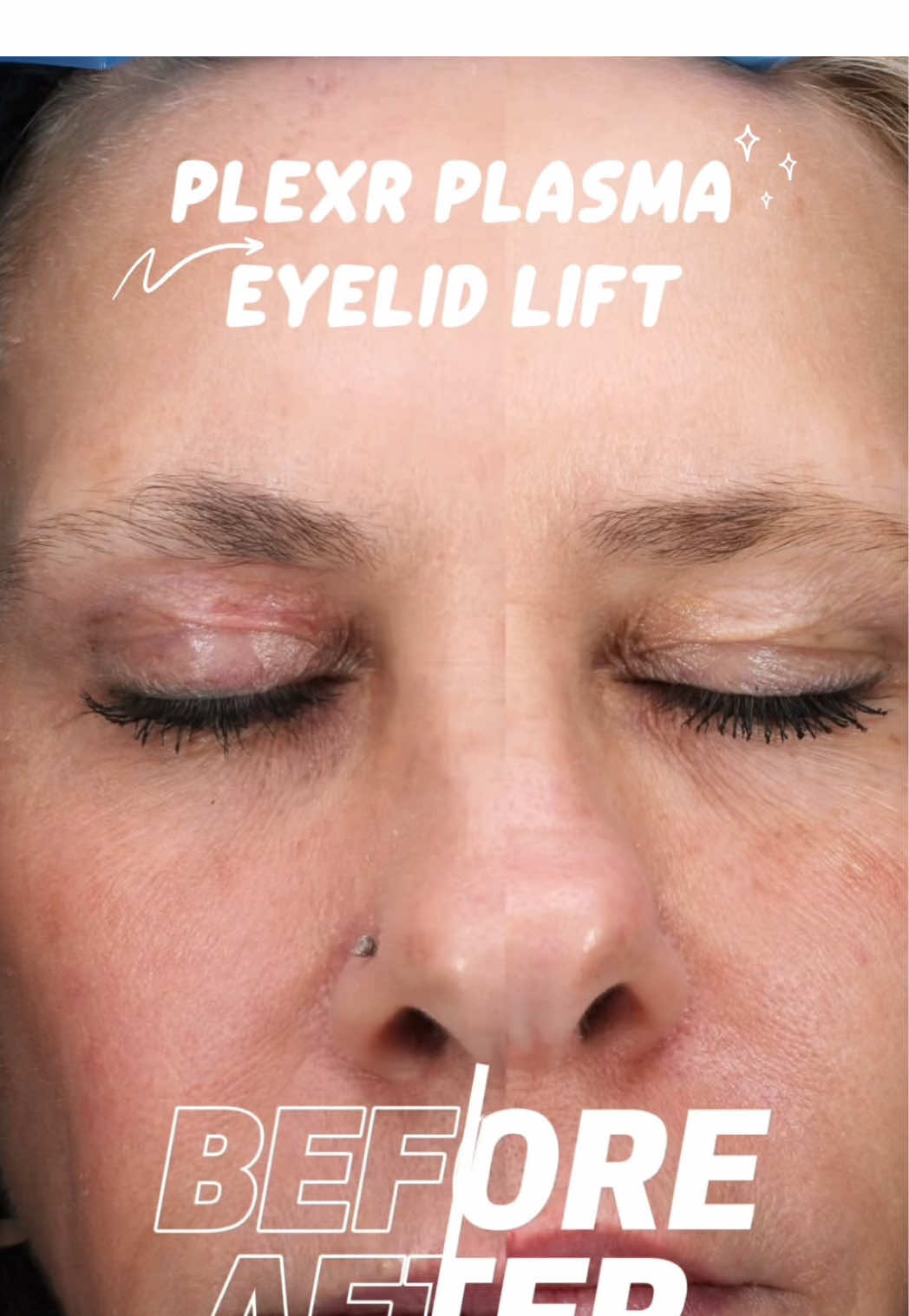 @AdvancedDermatology661