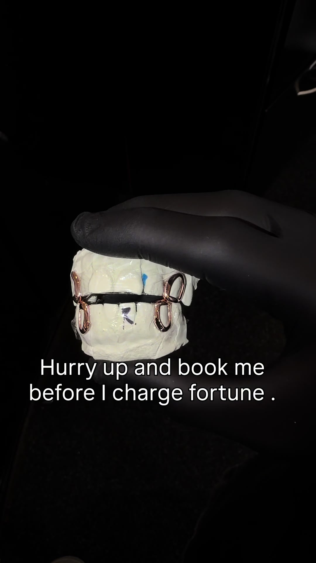 @AZ Grillz Plug