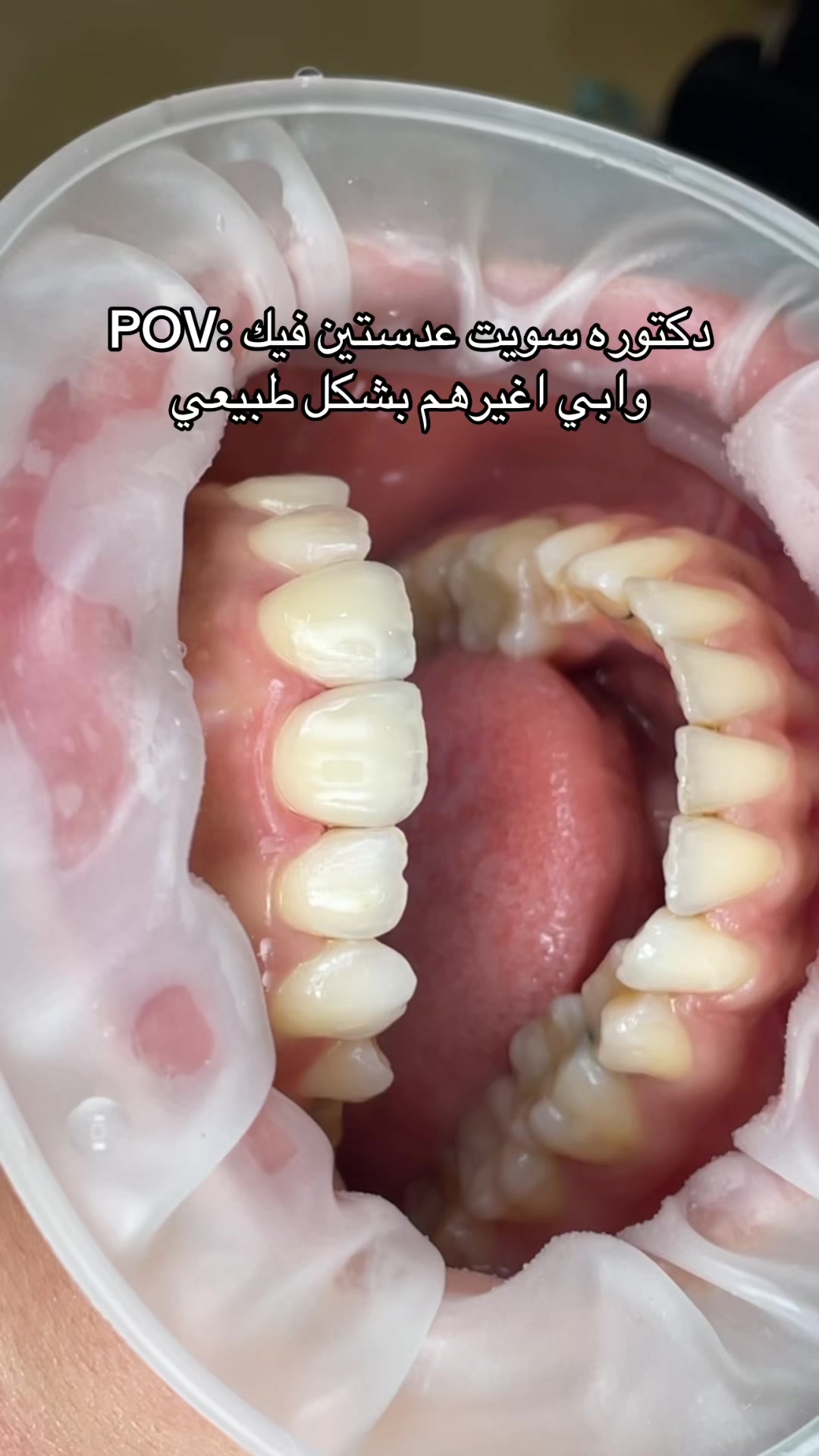 @Dr. Abrar Alhababi