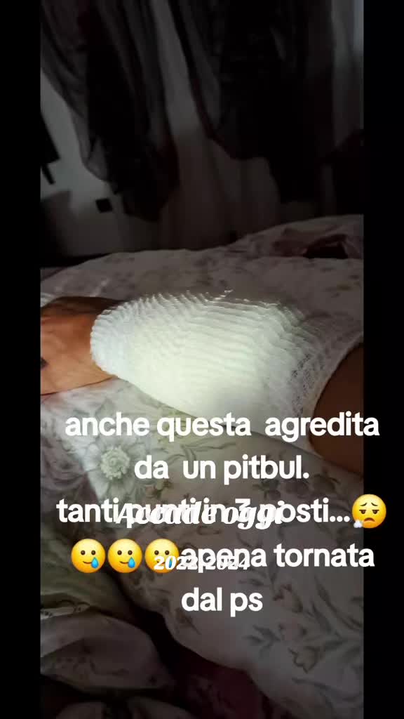 @ago 75