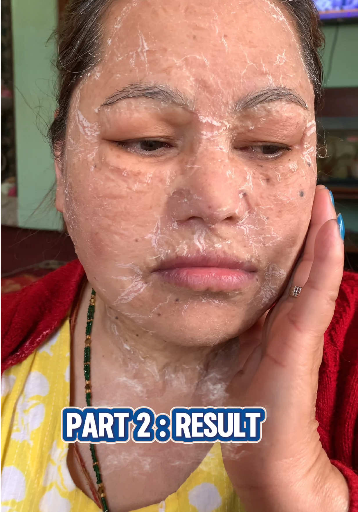 @Minimagic Skincare🇳🇵