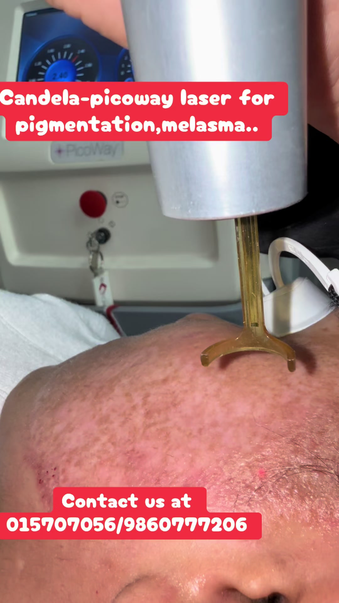 @Dr. Mainali, plastic surgeon