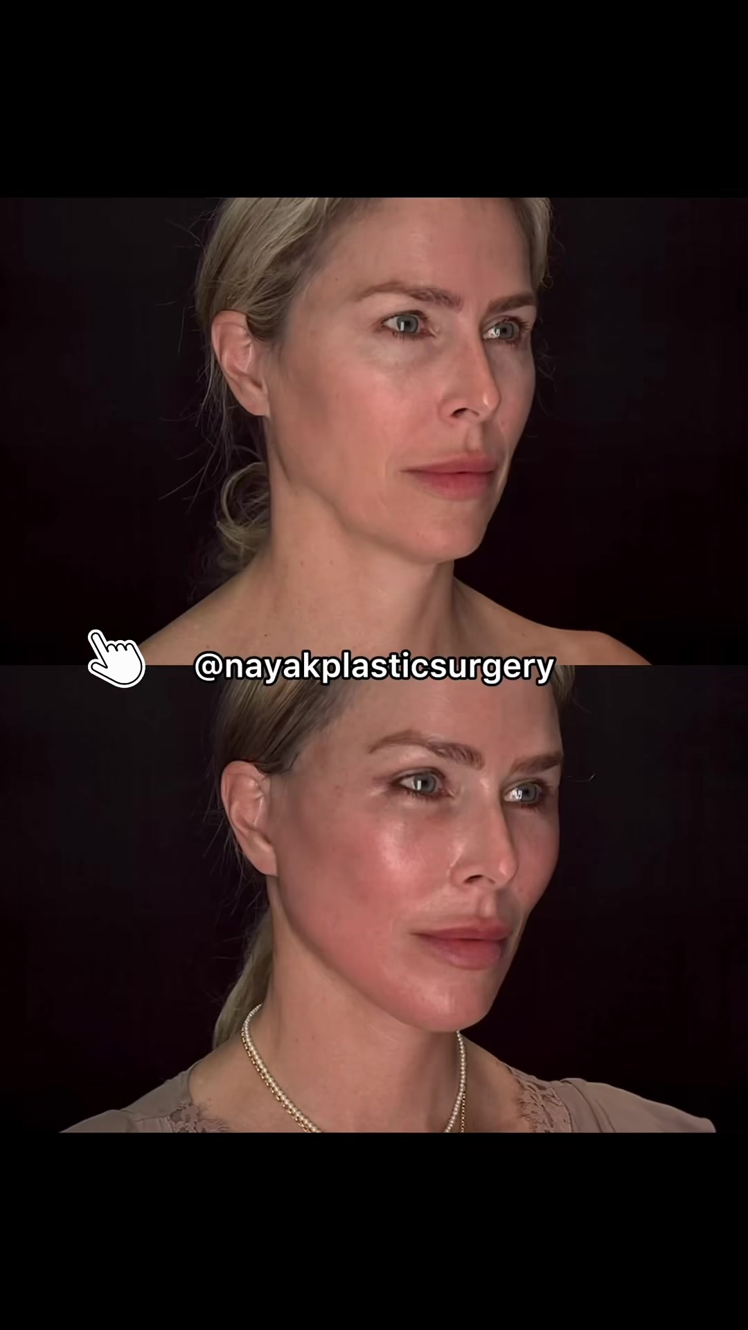 @NayakPlasticSurgery