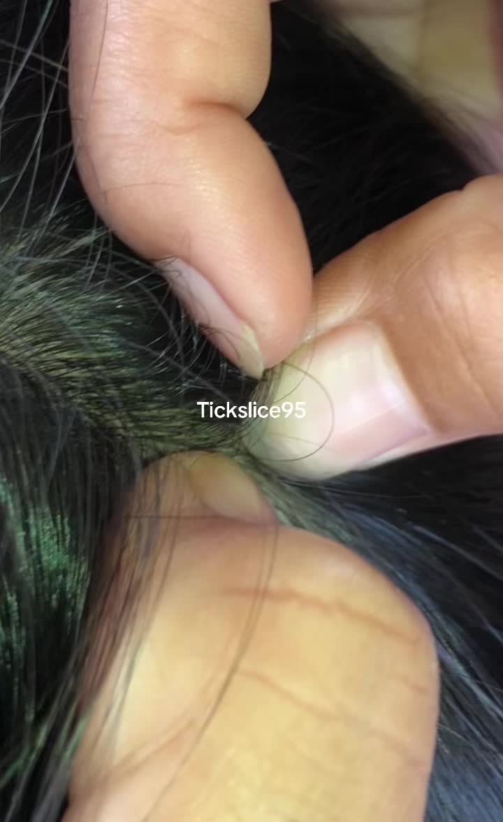 @Tickslice95