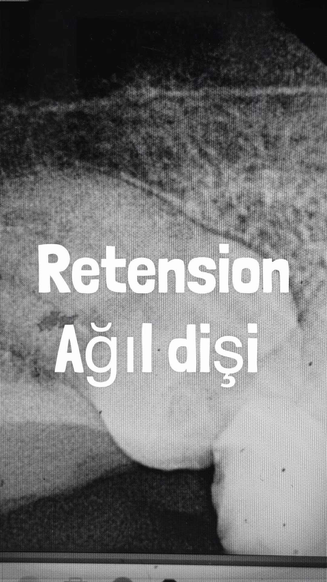 @Dr.Orxan