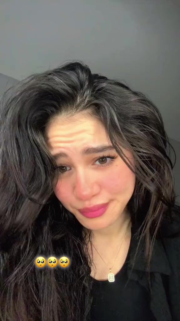 @NVX