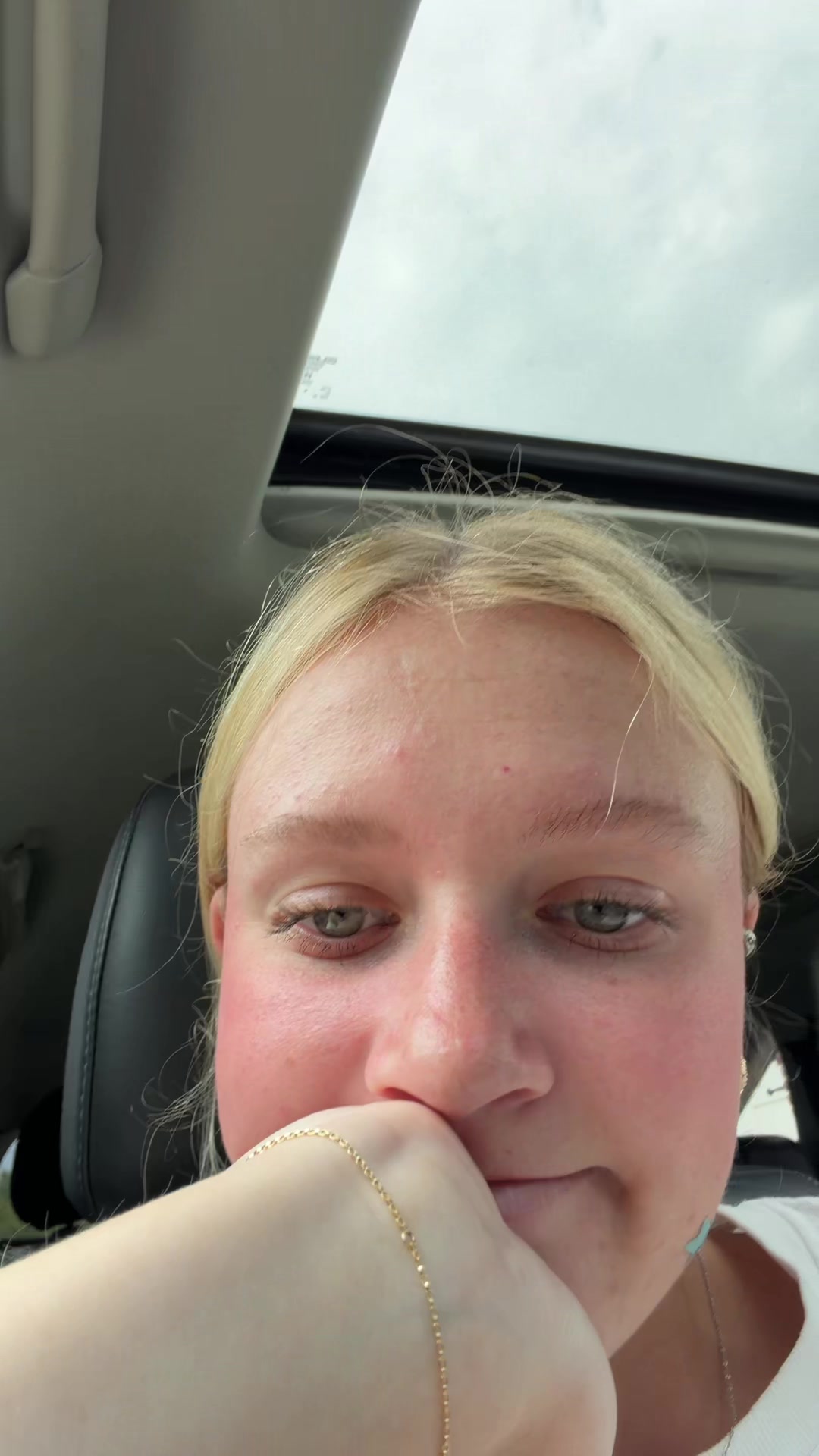 @em