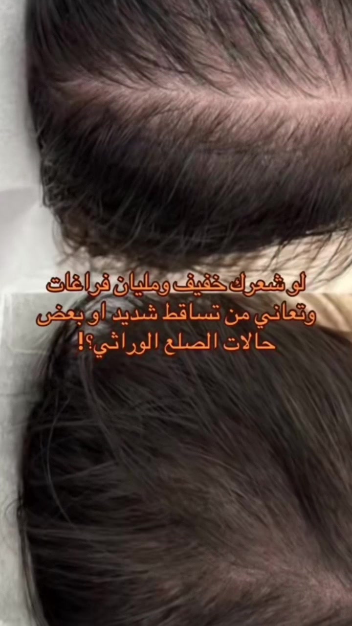 @رِقــة | RIQA