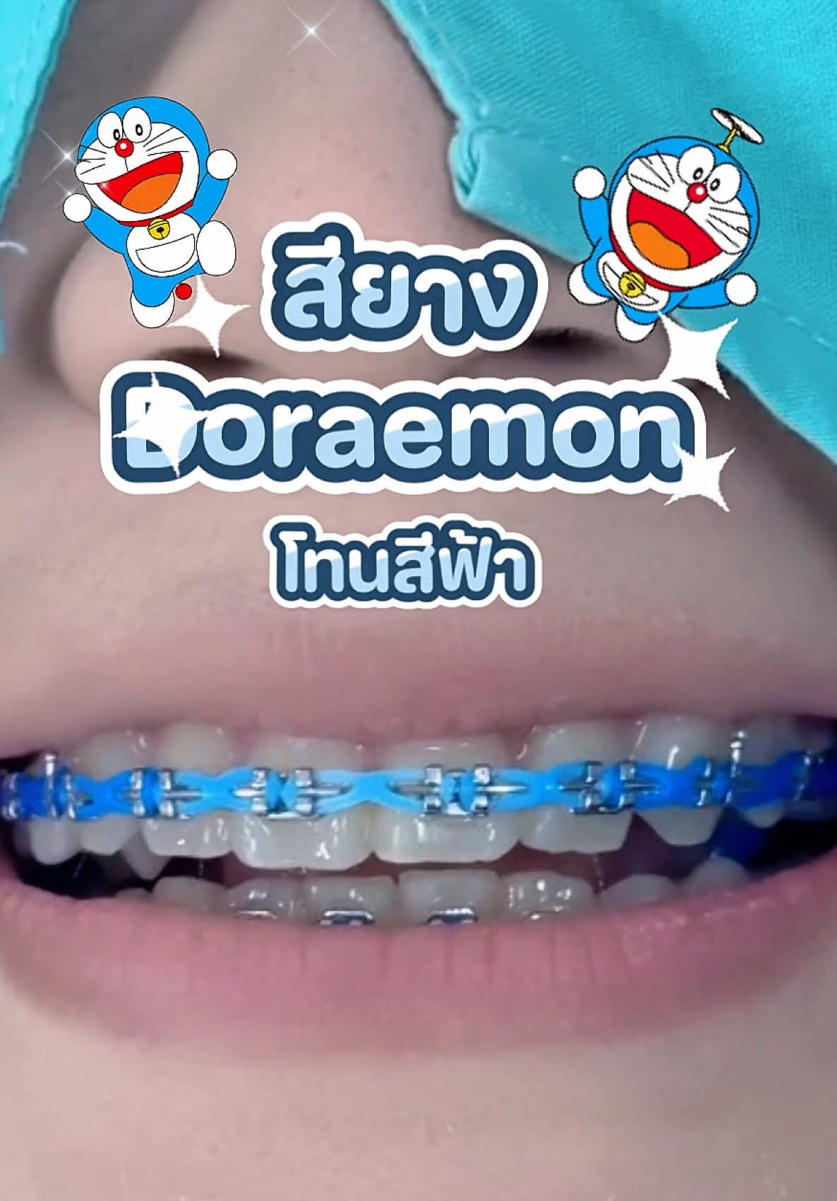 @ideasmilebu
