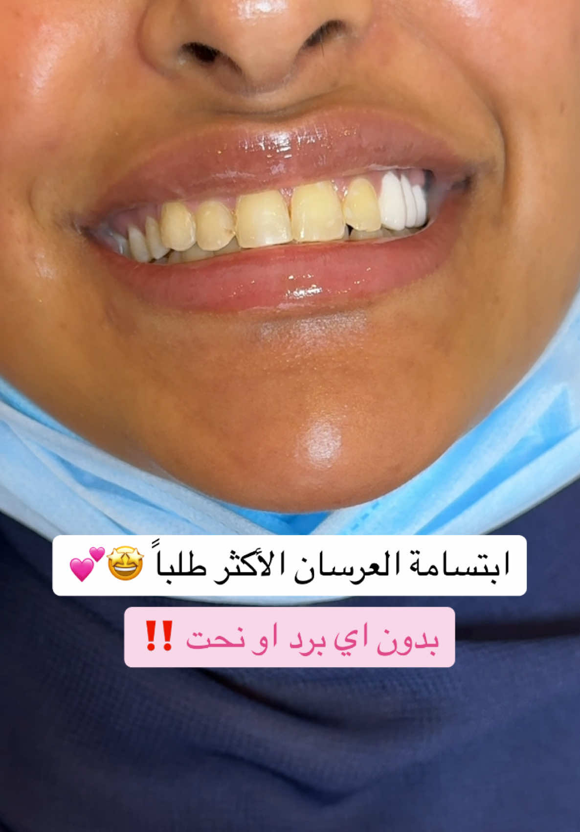 @Dr.lina_almasmoum