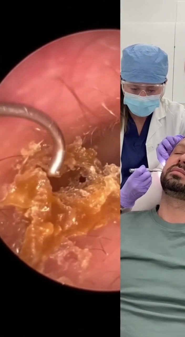 @Ear Cleaning