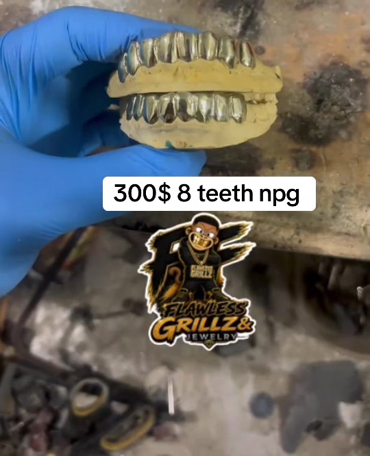 @Flawless Grillz