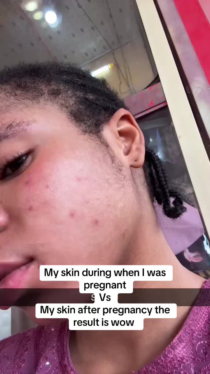 @Your skin solution🇳🇬🇬🇭🇬🇧