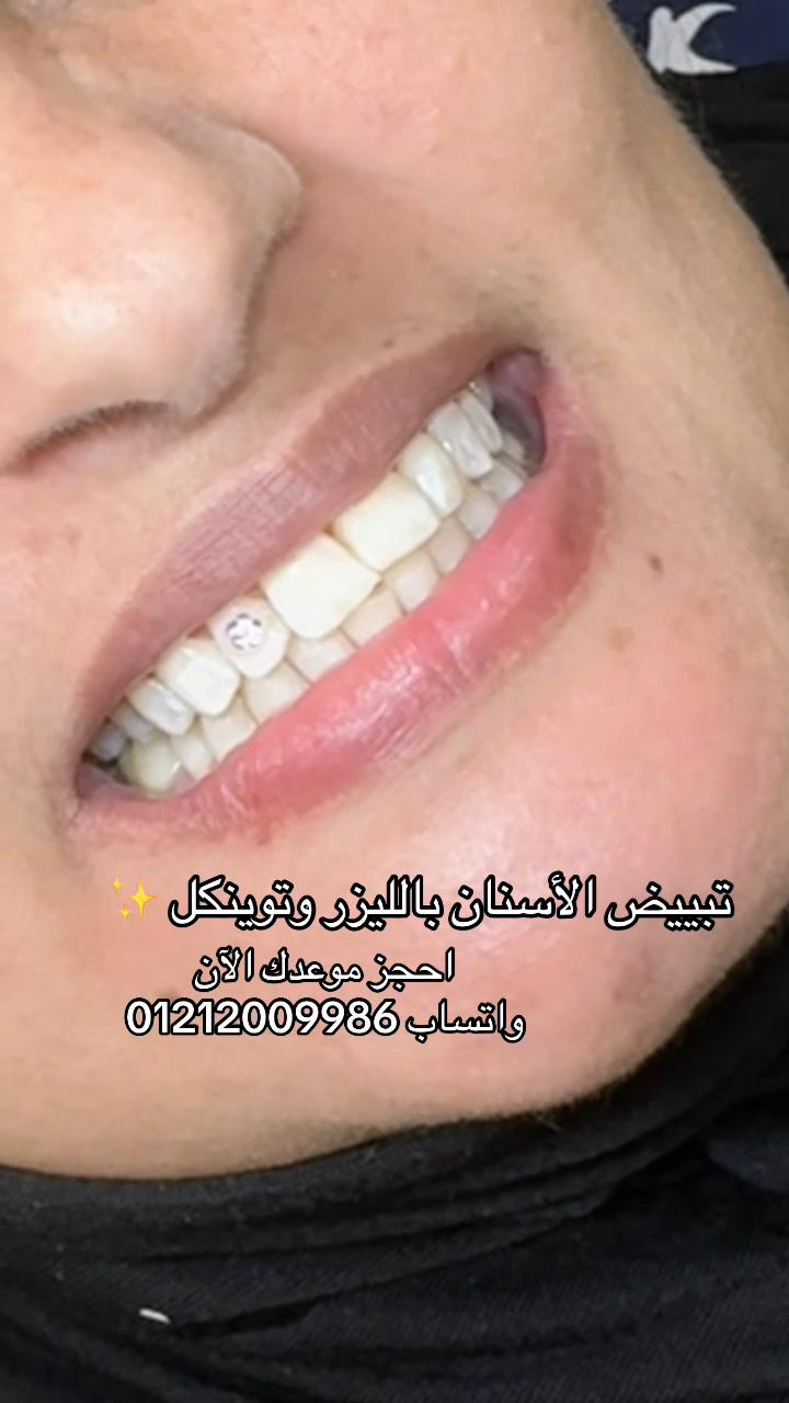 @Dr.mona.awd