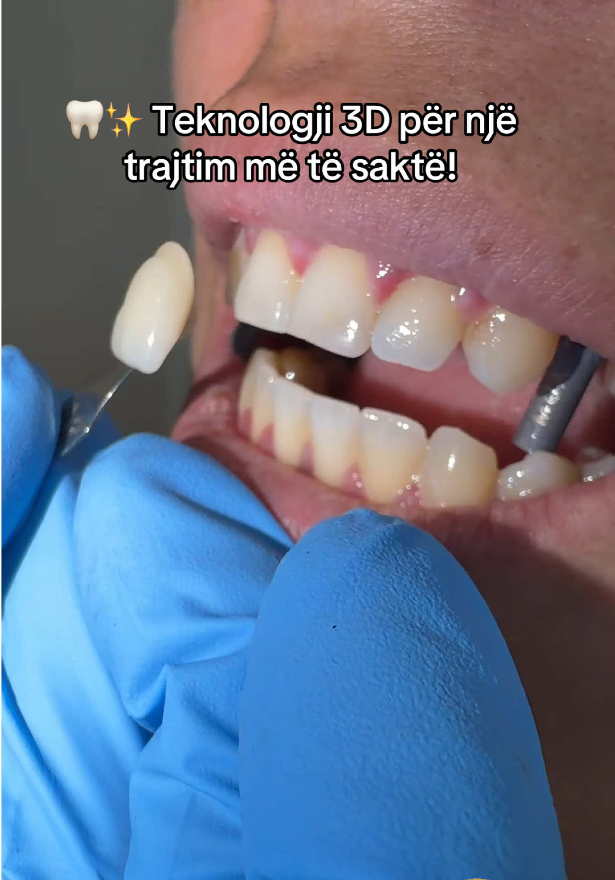 @Smile family_albania