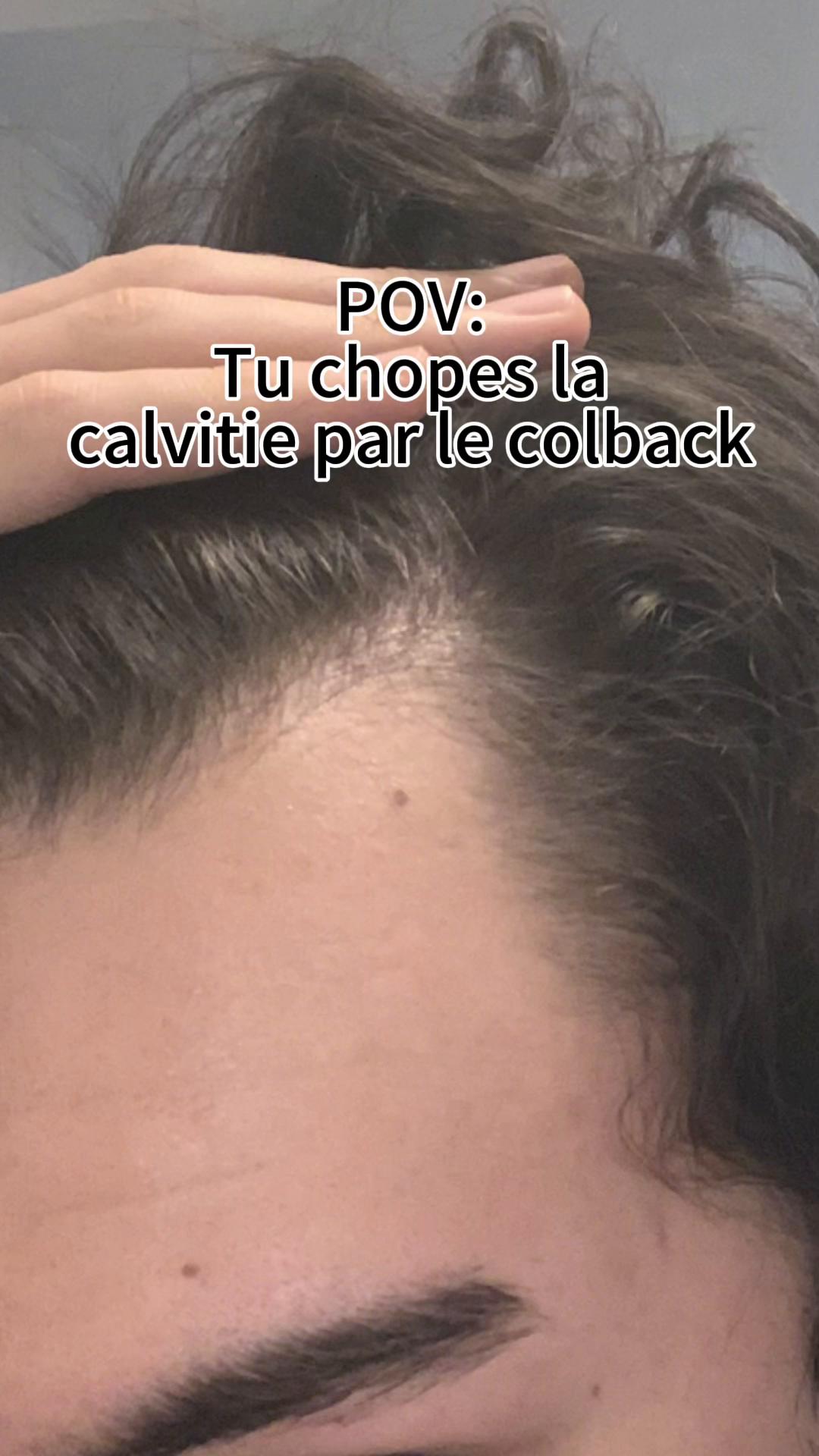 @Adam 2 Jours