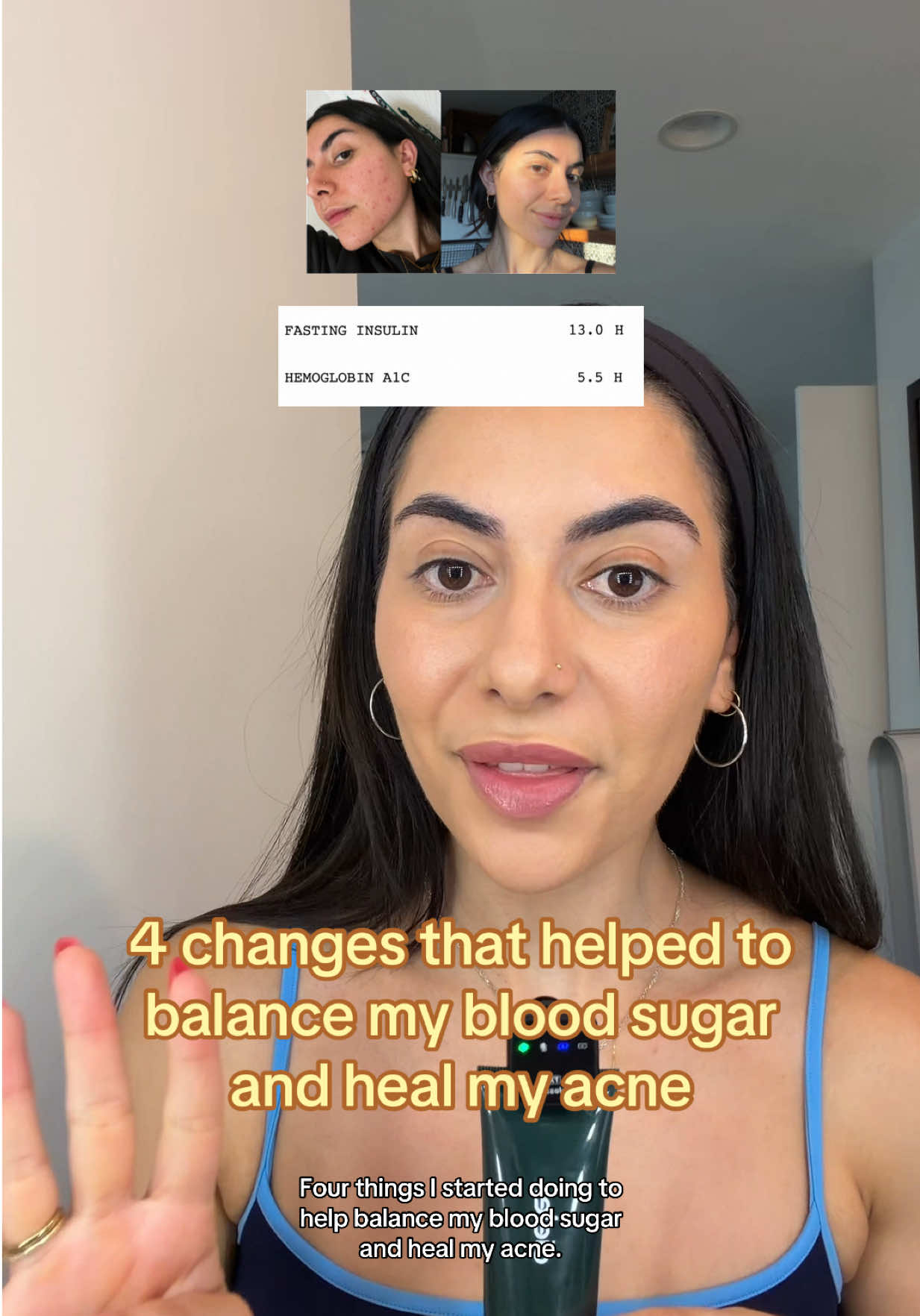@Doctor Sheyda | Acne Expert