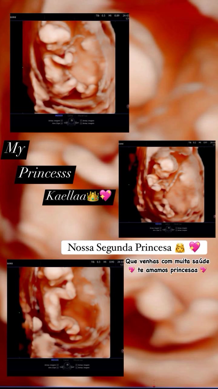 @♾️Mc.Ls♾️