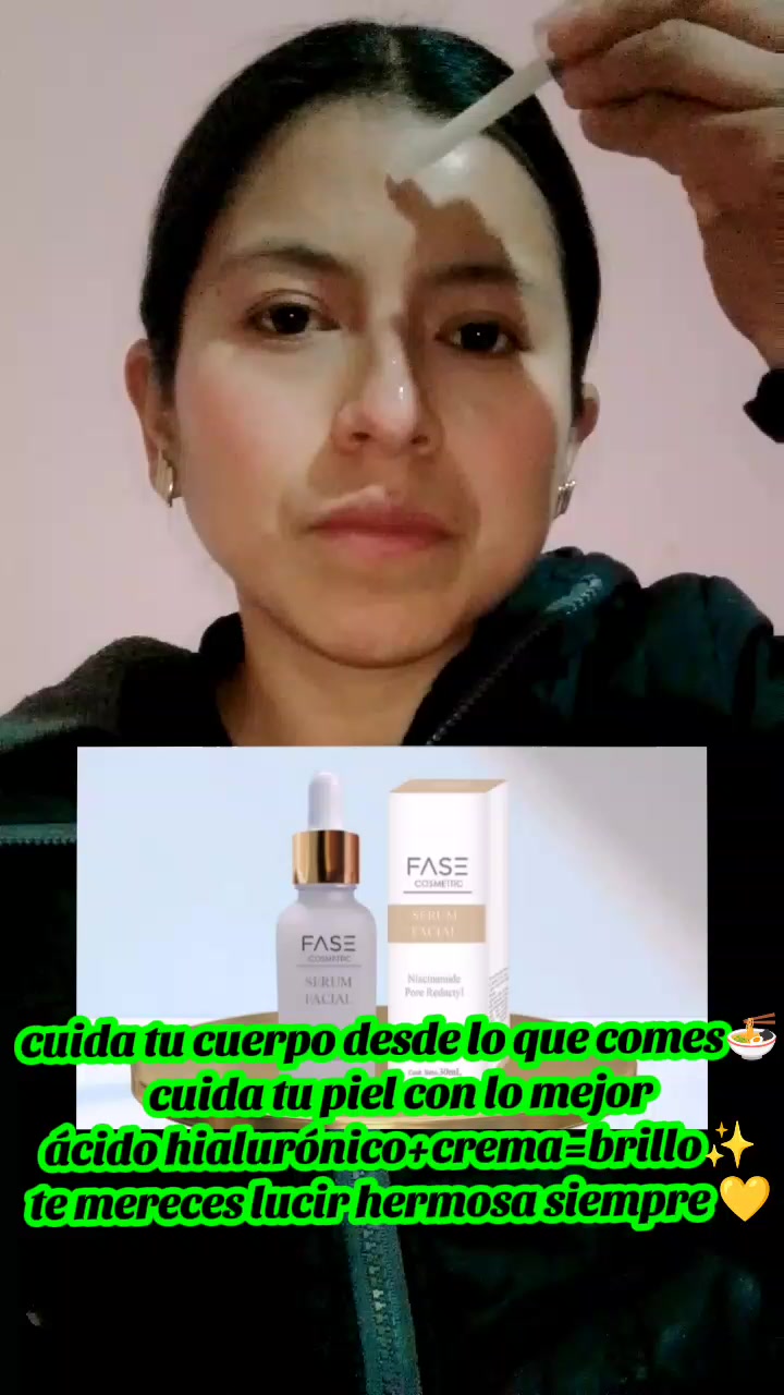 @Magali Noa