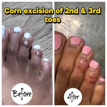 @Deniel Foot and Ankle Center