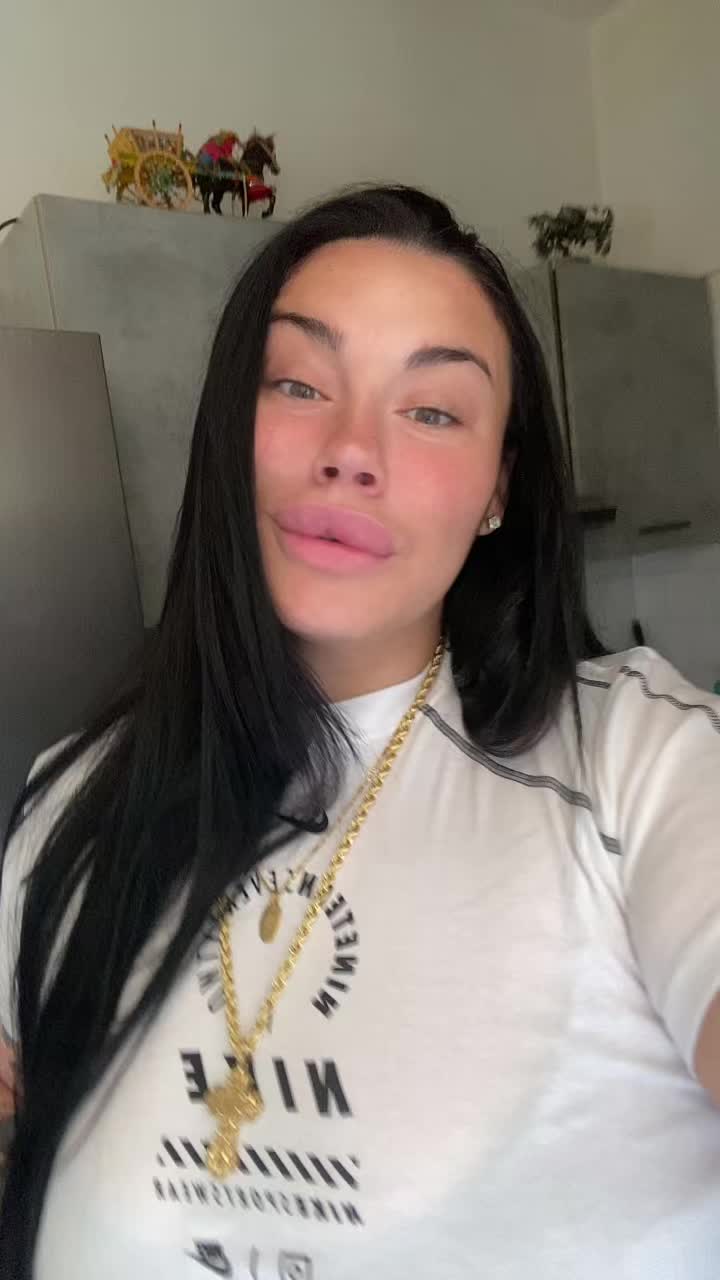 @Alessia albino