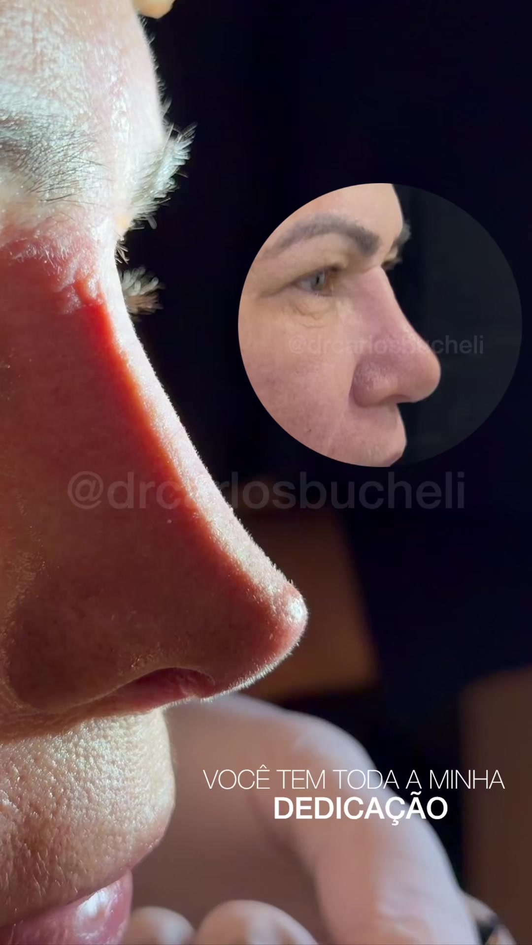 @Dr. Carlos Bucheli