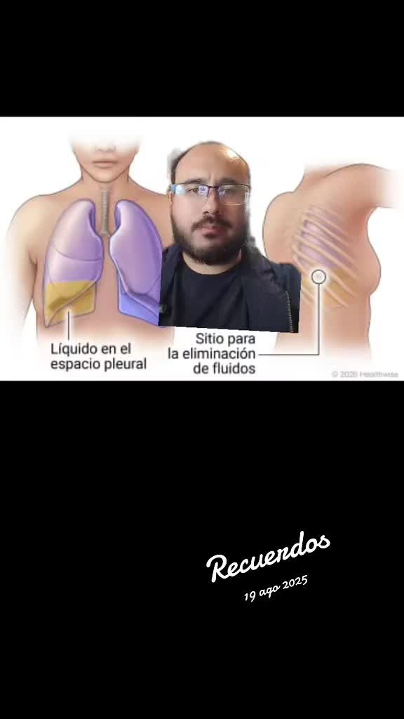 @Dr. Ajolote.