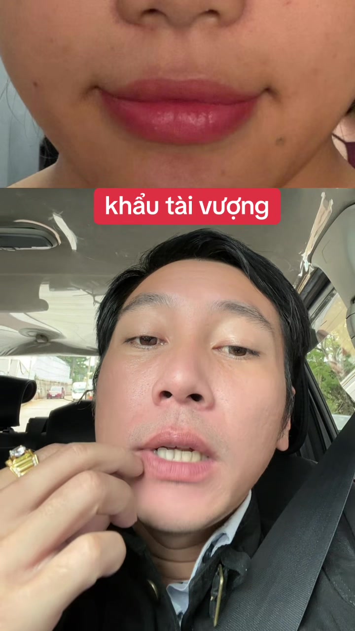 @Tuệ Nhãn ✅