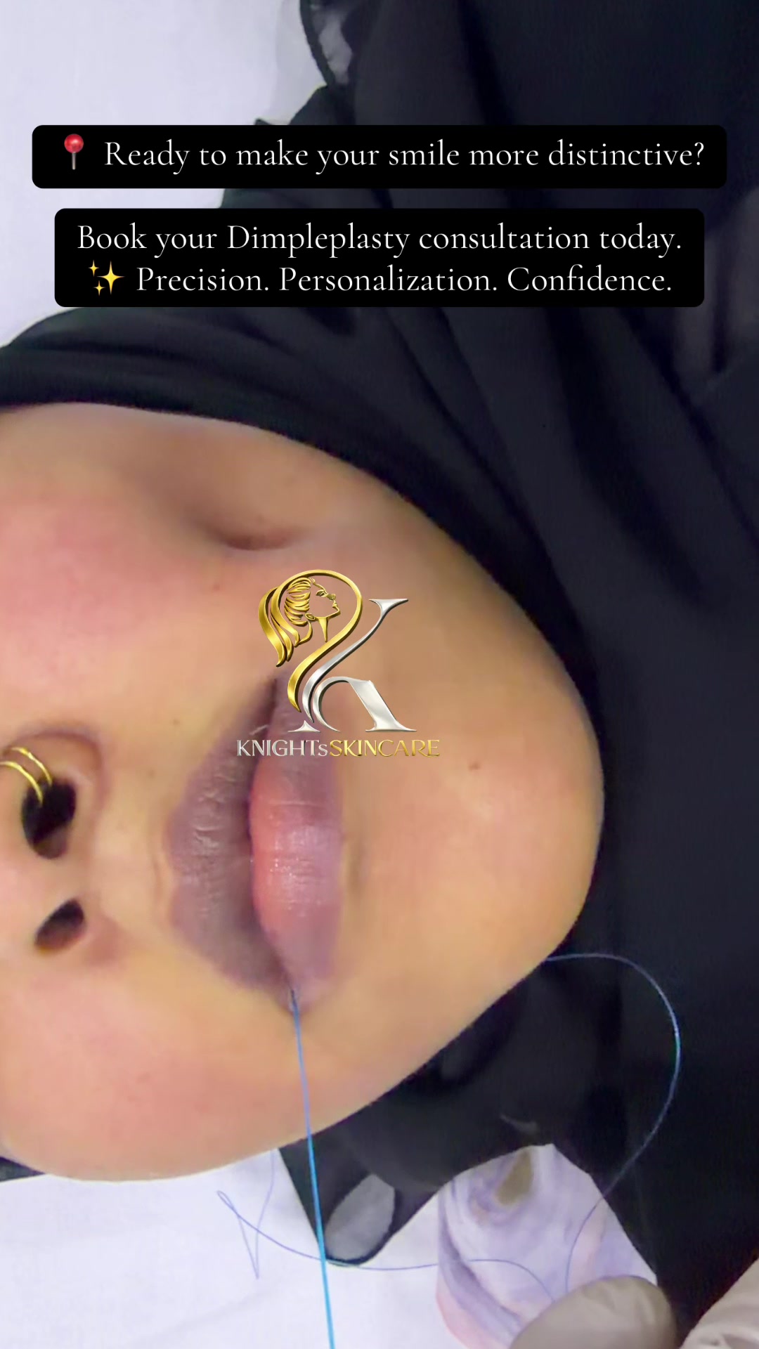 @KNIGHTS | SKINCARE | KENYA