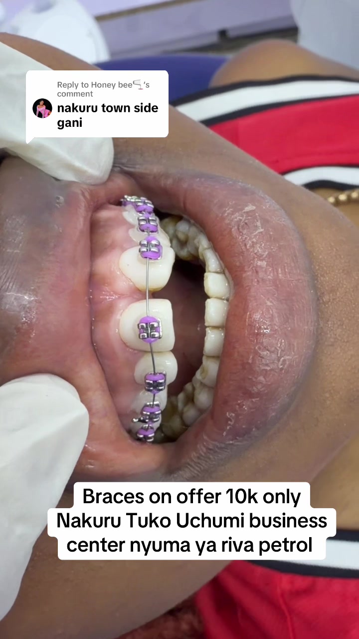 @Tiba dental care
