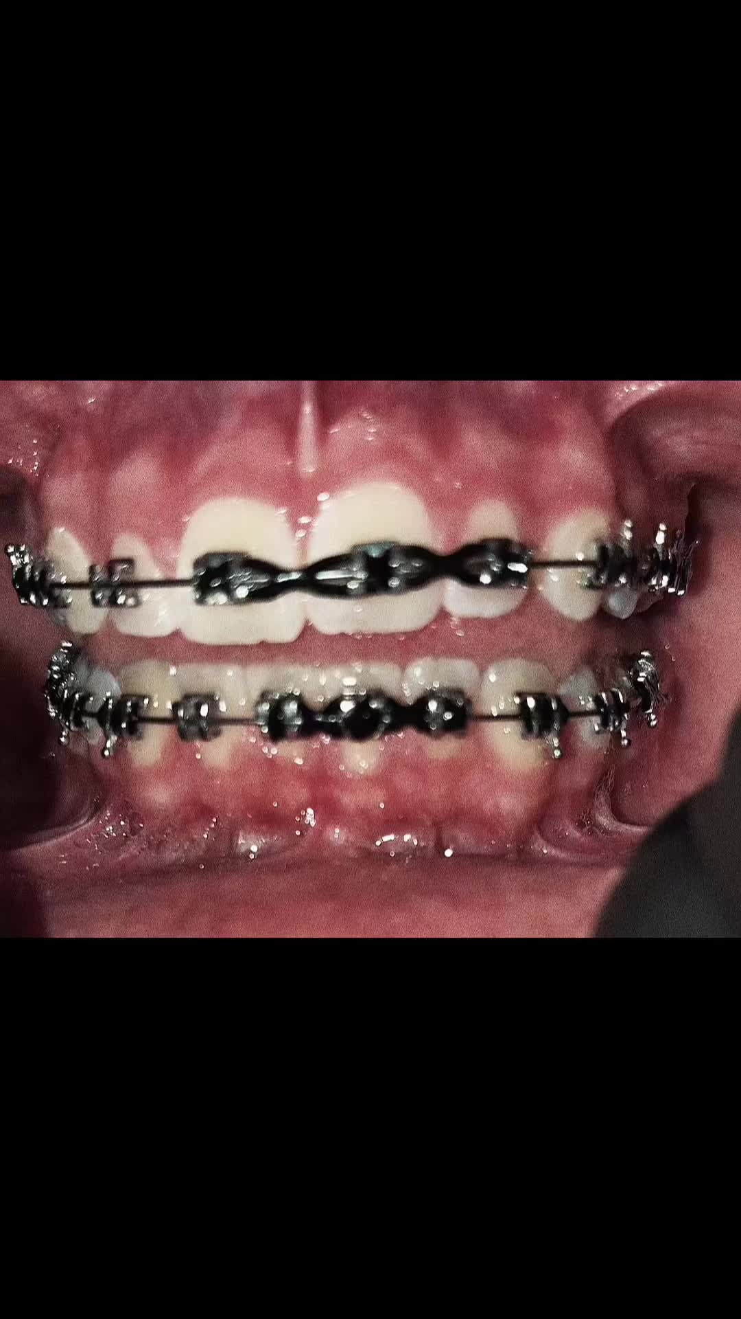 @⭐️//-Asher-//🦷