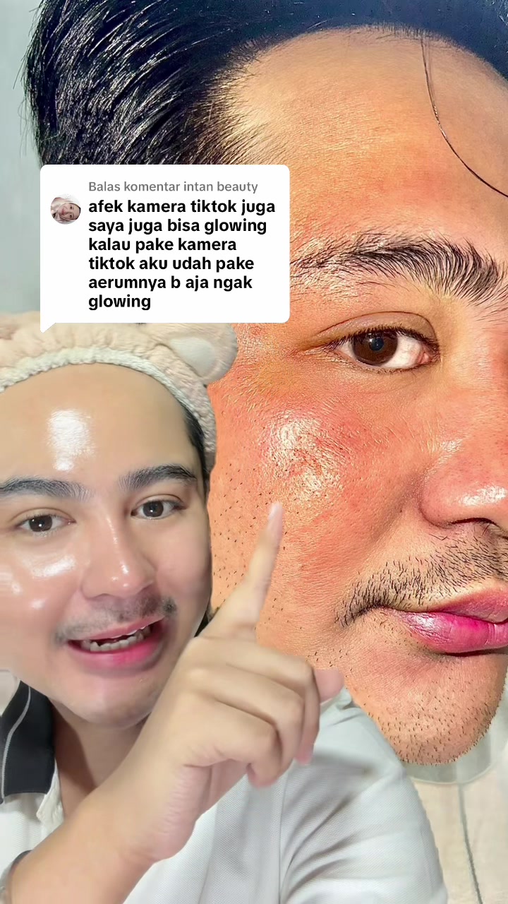 @Kimplus Skin IDN