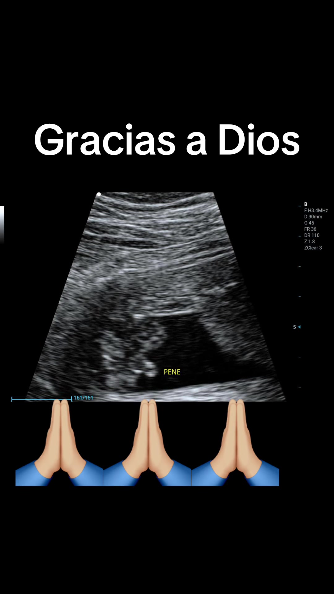 @chinolokon22