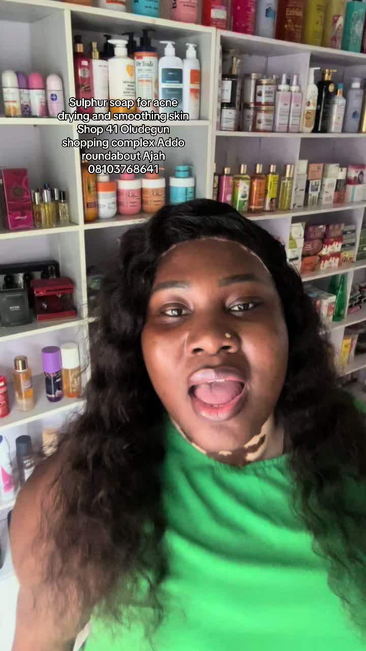 @Thevitiligogirl