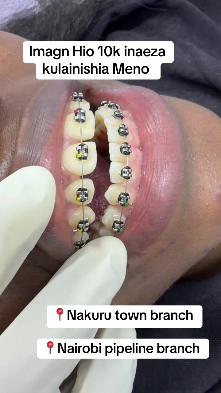 @Tiba dental care