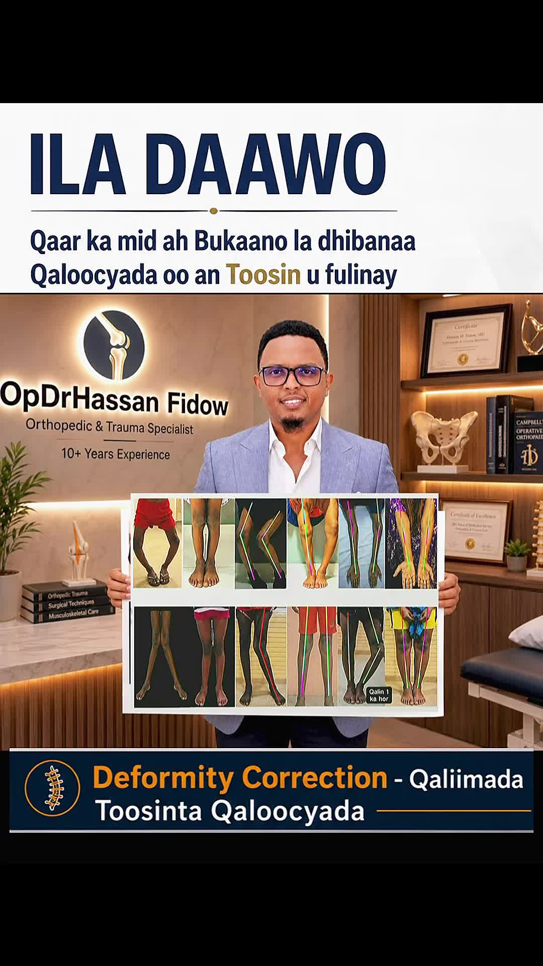 @DrHassan Fidow