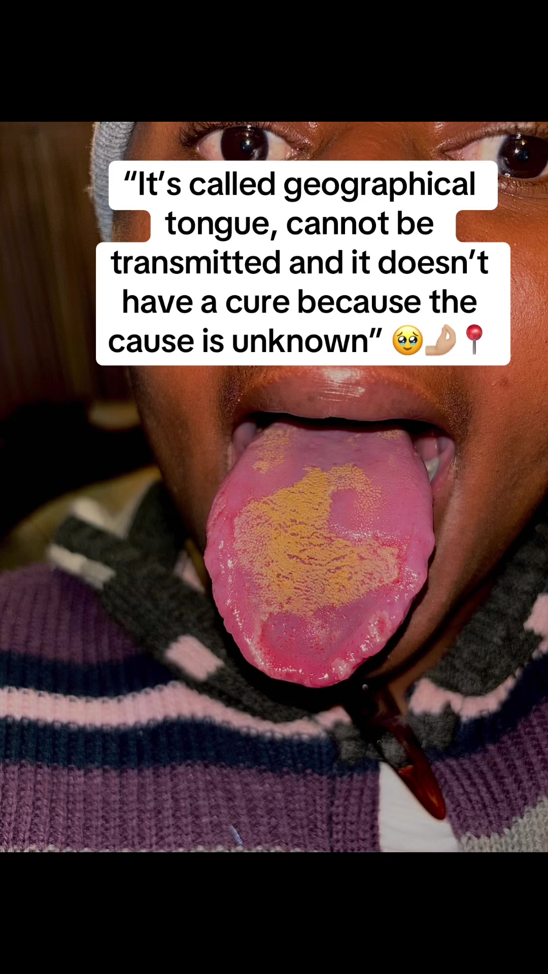 @Vinolia🤡