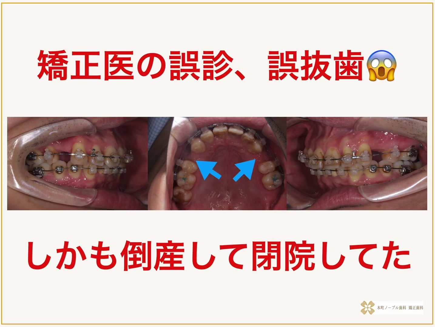 @谷口貴一(歯医者)