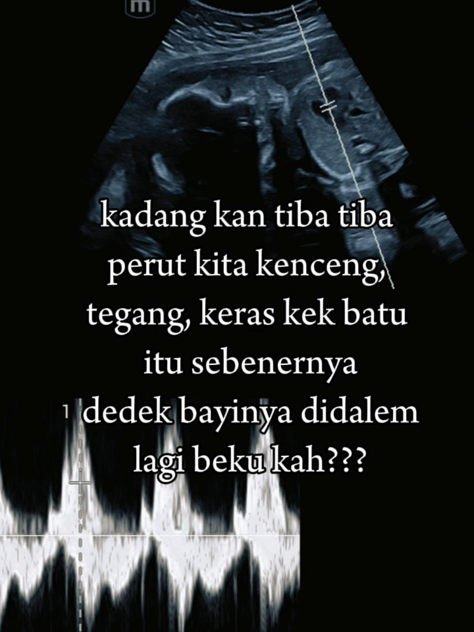 @Asri