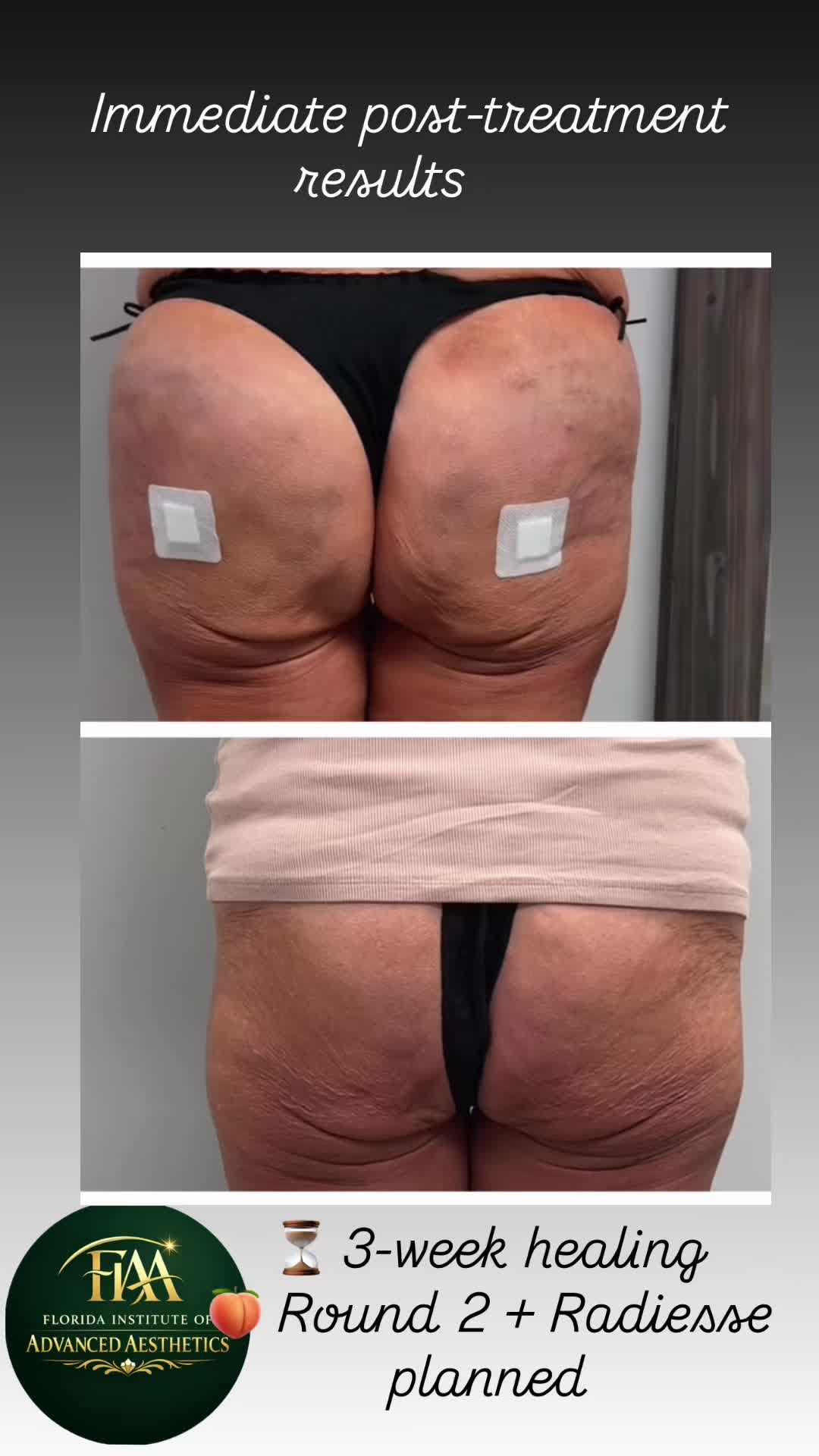 @FIAA | Advanced Aesthetics