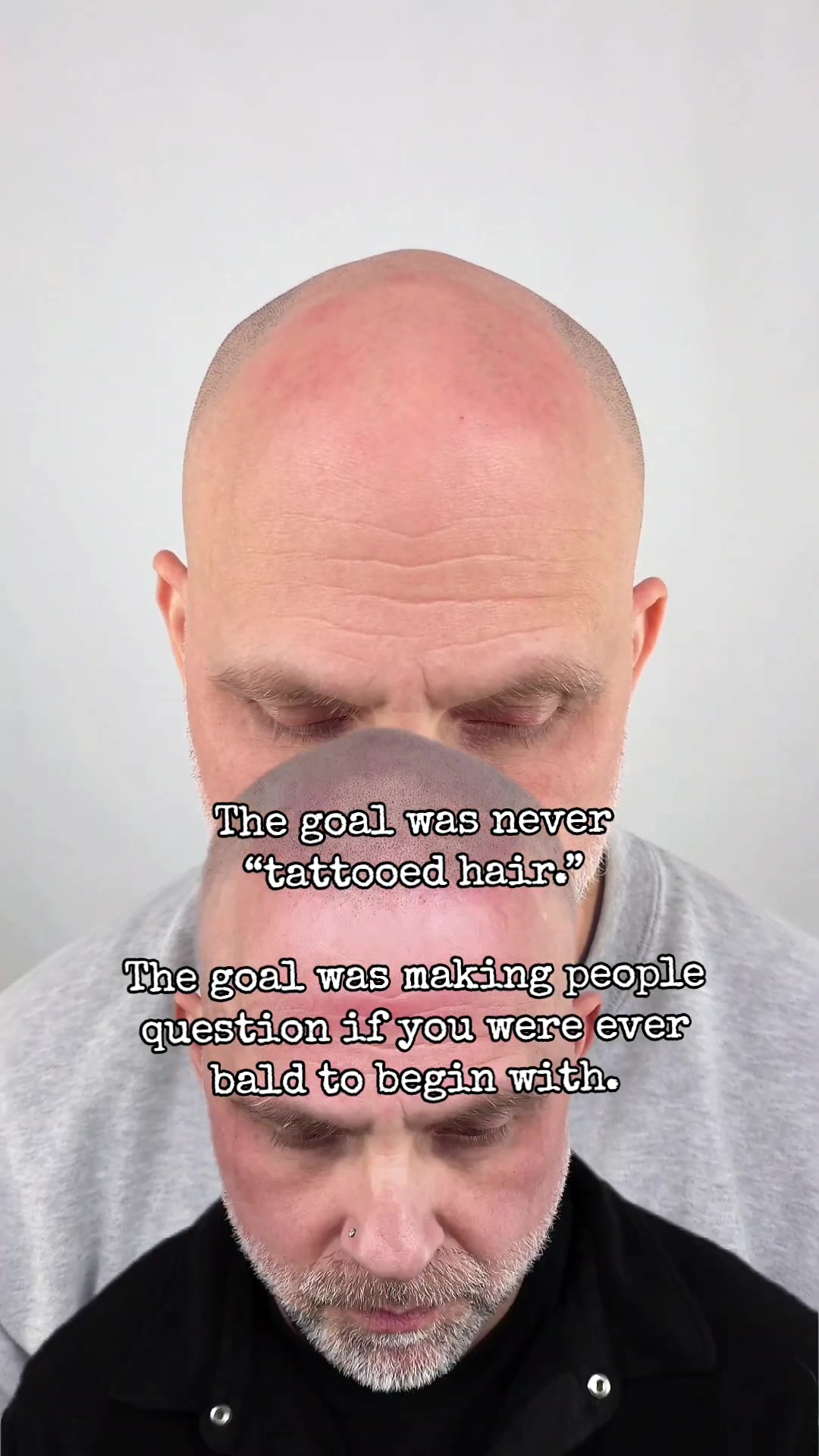 @Enhanced Scalp