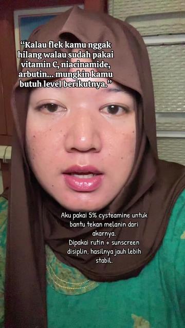 @ita_skinjourney