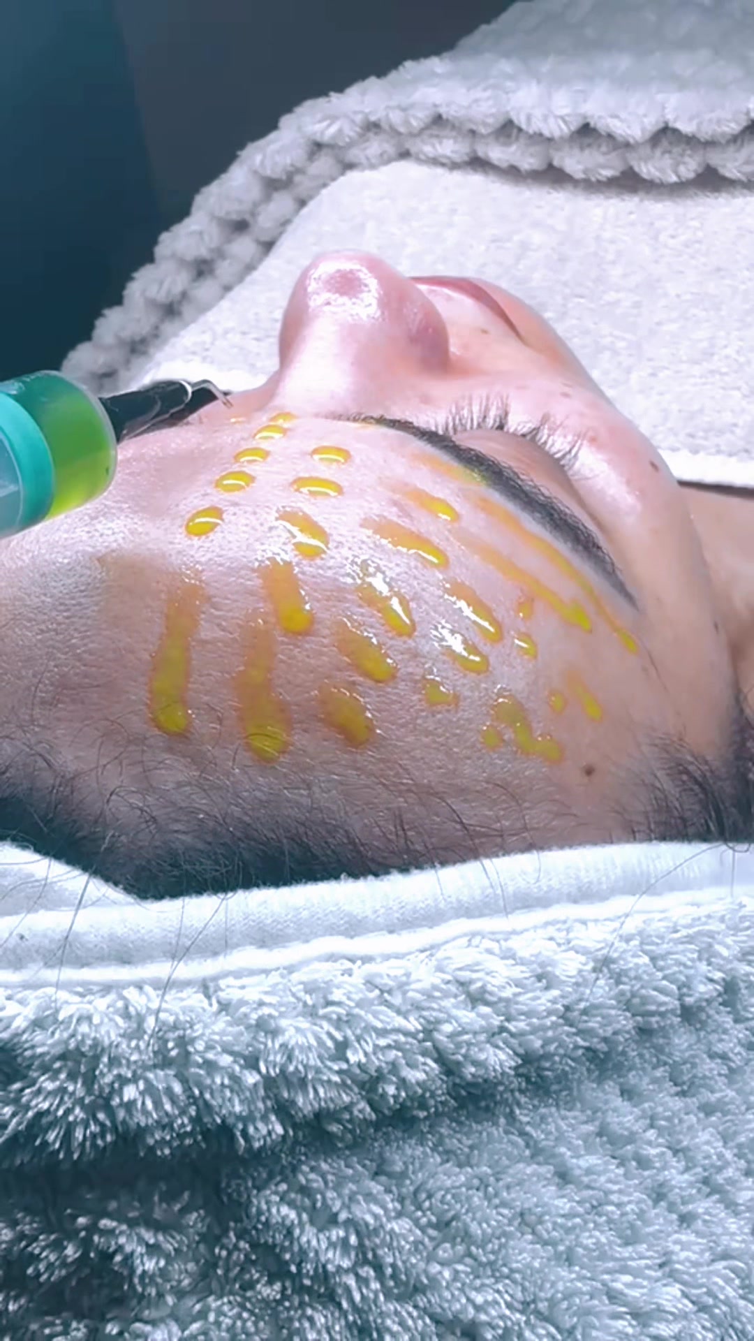 @GlowUp | Laserclinic & Beauty