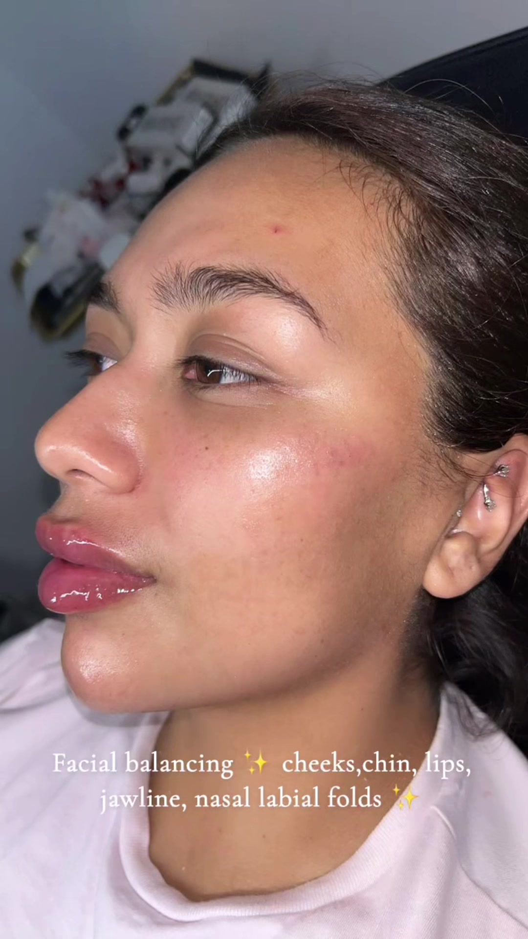 @injectormami